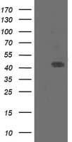 MAP2K1 / MKK1 / MEK1 Antibody (clone OTI2H3, Carrier-free)