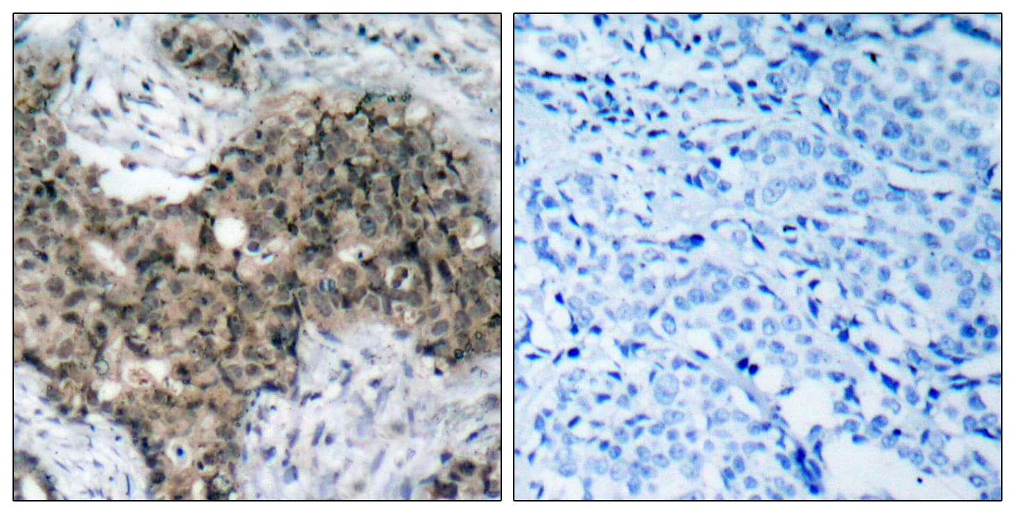 Polyclonal Rabbit anti-Human ATM Antibody (aa1950-1999, IHC)
