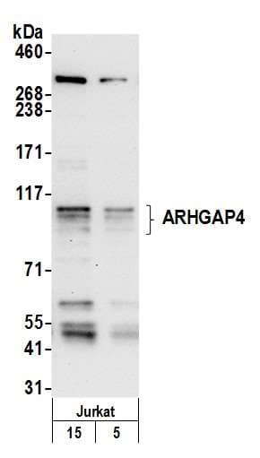Polyclonal Rabbit anti-Human ARHGAP4 Antibody (aa350-400, WB)