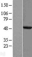 PHYKPL / AGXT2L2 Protein (Over-Expression Lysate Myc-DDK (Flag))