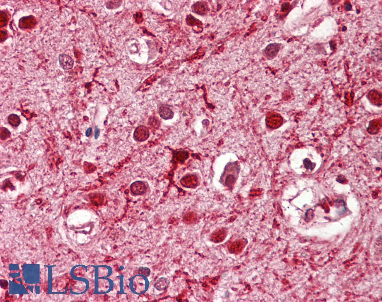 IHC-plus™ Polyclonal Goat anti-Mouse ASCL3 Antibody (aa118-130, IHC, WB)