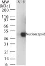 SARS-CoV Nucleoprotein Antibody (aa399-411)