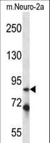 IRAK1 / IRAK Antibody (aa405-433)