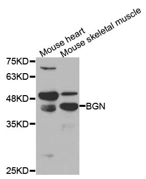 Polyclonal Rabbit anti-Human BGN / Biglycan Antibody (WB)