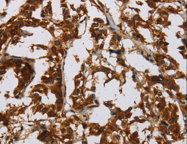 CLDN8 / Claudin 8 Antibody