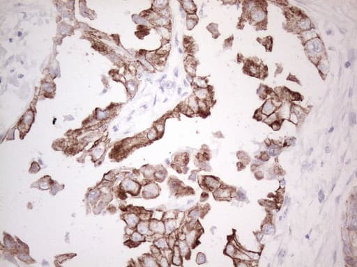 Monoclonal Mouse anti-Human KRT19 / CK19 / Cytokeratin 19 Antibody (clone UMAB188, Carrier-free, aa240-390, IHC, IF, WB)