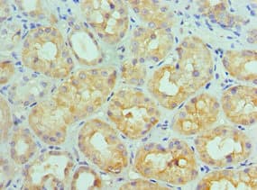 IL11RA Antibody (aa30-290)