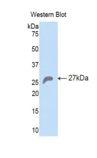 HSPA5 / GRP78 / BiP Antibody (aa261-470)