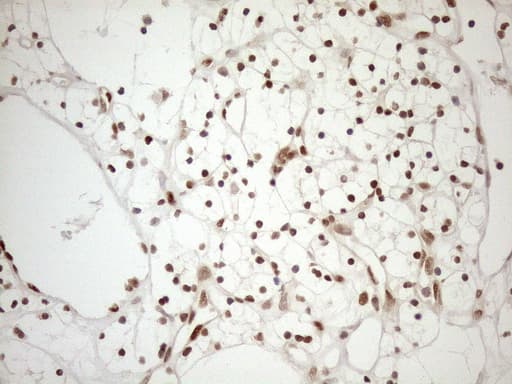 MGMT Antibody (clone OTI5A7)