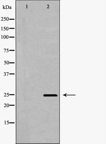 CTLA4 / CD152 Antibody