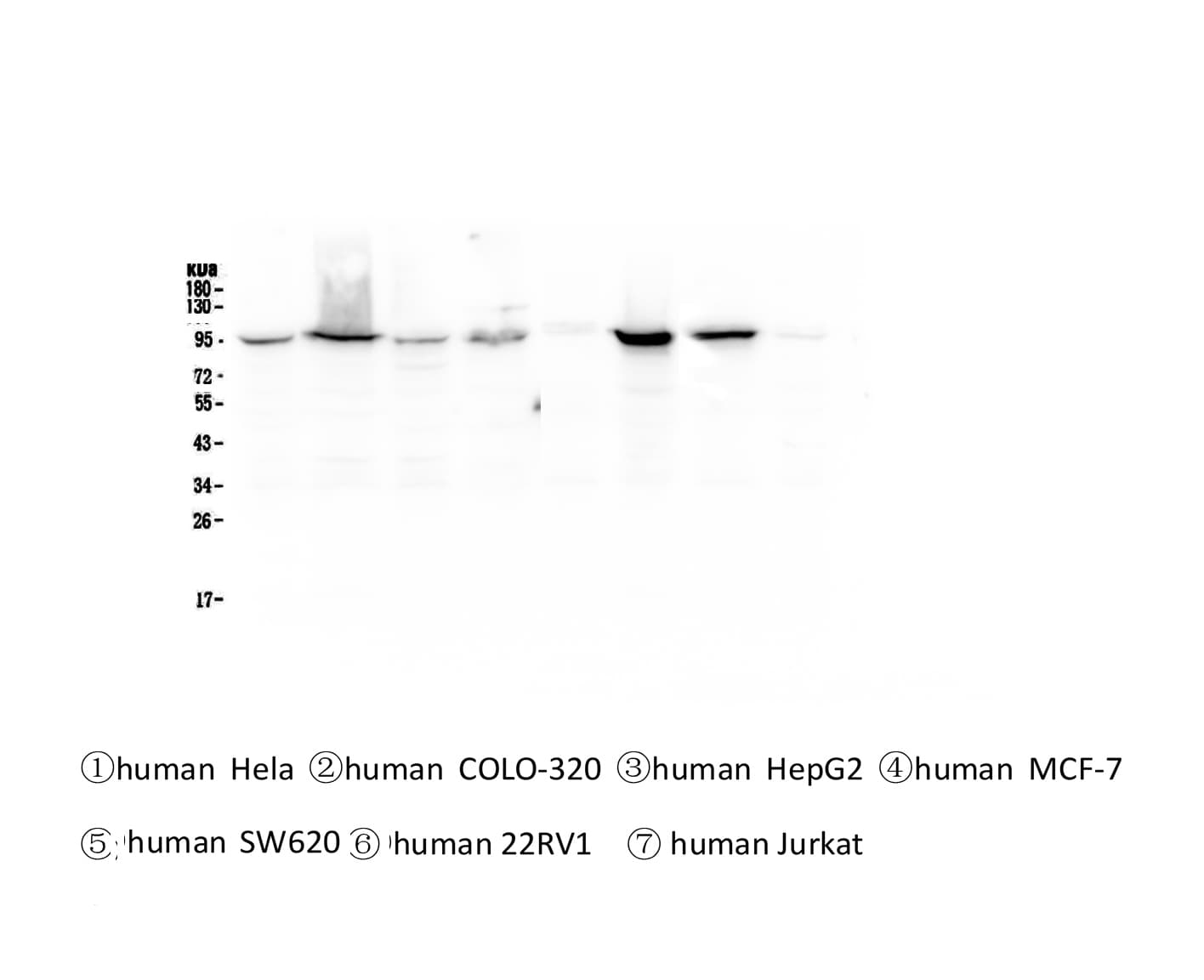 CTNNB1 / Beta Catenin Antibody