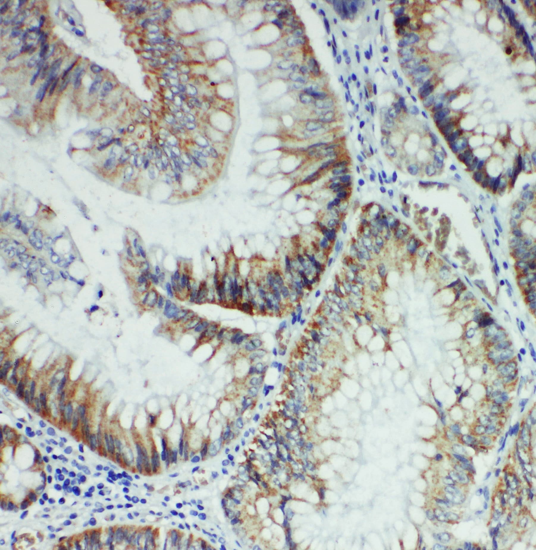 FER Antibody (aa521-536)