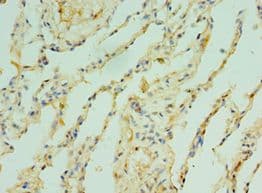 TOMM40 / TOM40 Antibody (aa1-361)