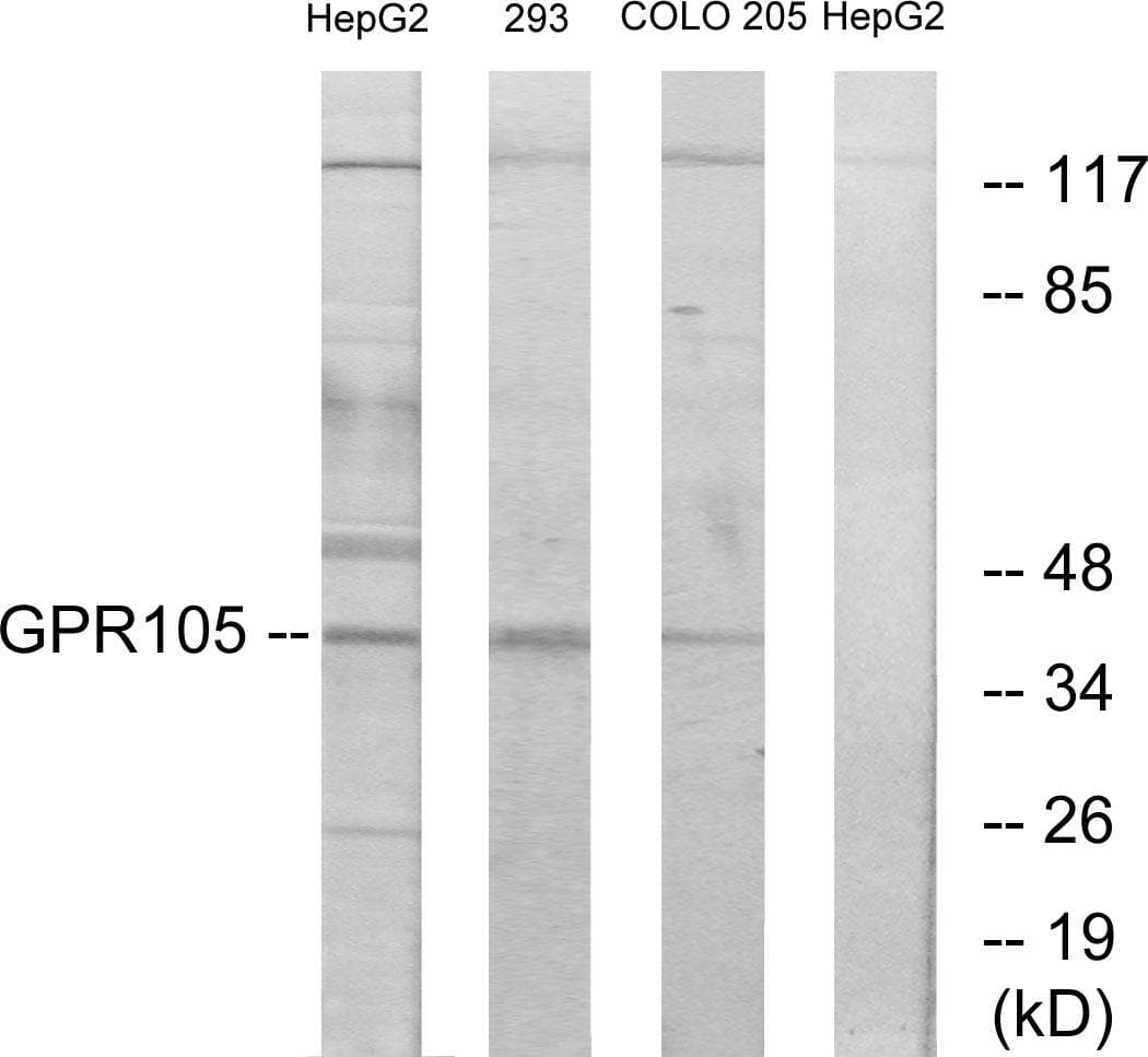 P2RY14 / GPR105 Antibody