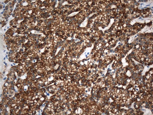 PTH / Parathyroid Hormone Antibody (aa32-115, clone UMAB274)