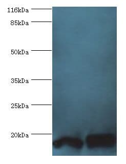 Polyclonal Rabbit anti-Human POP7 Antibody (aa1-140, IHC, WB)