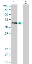 IHC-plus™ FANCC Antibody (clone 6E7)