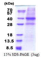 Human CAPZA2 / CAPZ Alpha 2 Protein (Recombinant His)