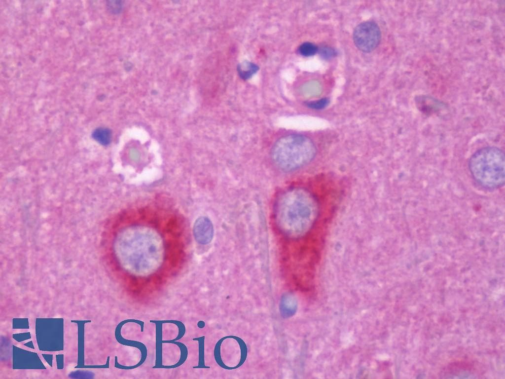 IHC-plus™ RAB6A / RAB6 Antibody (aa1-208)