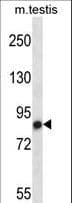 Polyclonal Rabbit anti-Mouse NEK4 Antibody (aa74-101, WB)