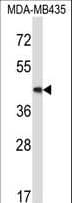 MAP2K5 / MEK5 Antibody (aa385-412)