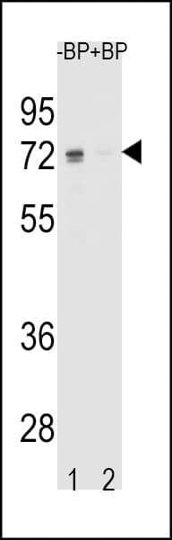 ER Alpha / Estrogen Receptor Antibody (aa452-480)