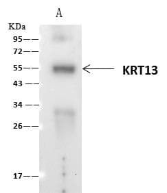 KRT13 / CK13 / Cytokeratin 13 Antibody (Preservative Free)