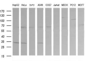 RARRES1 Antibody (clone OTI2E12)