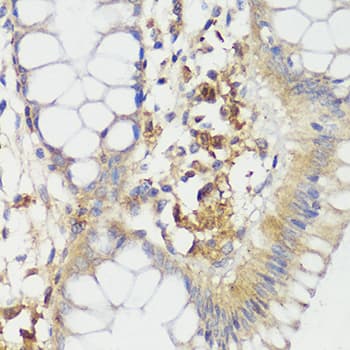 Polyclonal Rabbit anti-Human HTRA3 Antibody (IHC, WB)