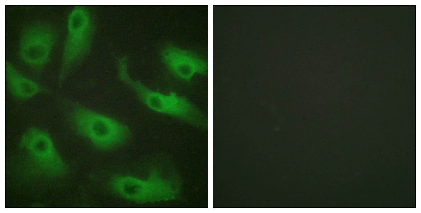 IHC-plus™ Polyclonal Rabbit anti-Human CDC37 Antibody (aa1-50, IHC, IF, WB)
