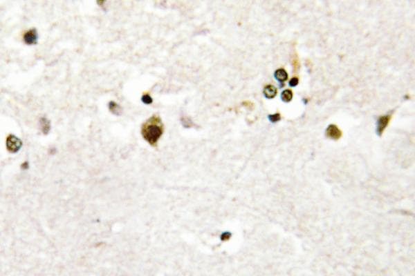 Polyclonal Rabbit anti-Human HES6 Antibody (Ala6, IHC, WB)