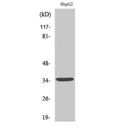 CD1E Antibody (190-270 aa, Internal)