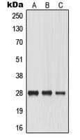 Polyclonal Rabbit anti-Human MIP / AQP0 / Aquaporin 0 Antibody (Internal, WB)