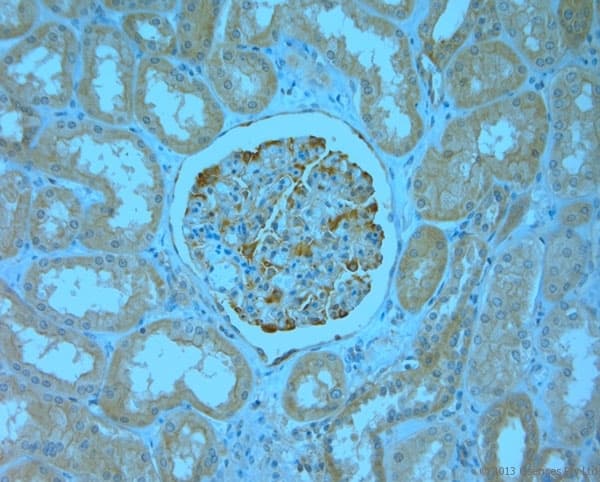 Polyclonal Rabbit anti-Human MPP1 Antibody (aa410-460, IHC)