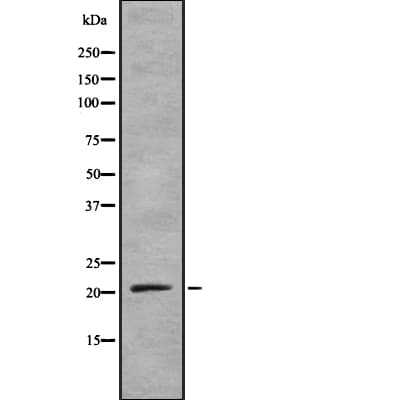 TNFSF4 / OX40L / CD252 Antibody
