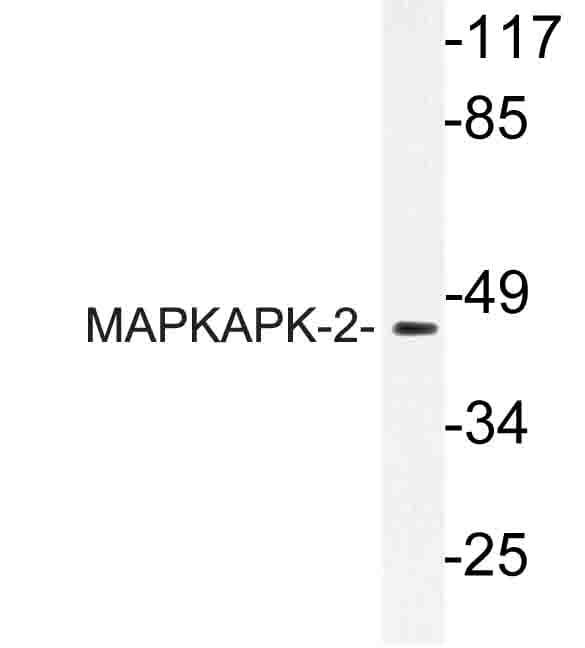 MAPKAPK2 / MAPKAP Kinase 2 Antibody (Asn266)