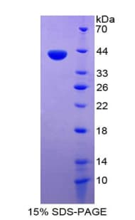 Human I-309 / CCL1 Protein (Recombinant His-GST)