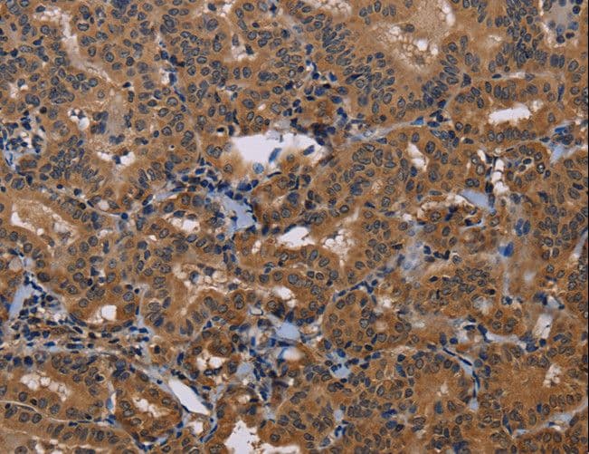Rhodopsin Kinase / GRK1 Antibody