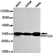 IHC-plus™ Monoclonal Mouse anti-Human PPP1CA / PP1-Alpha Antibody (N-Terminus, IHC, IF, WB)