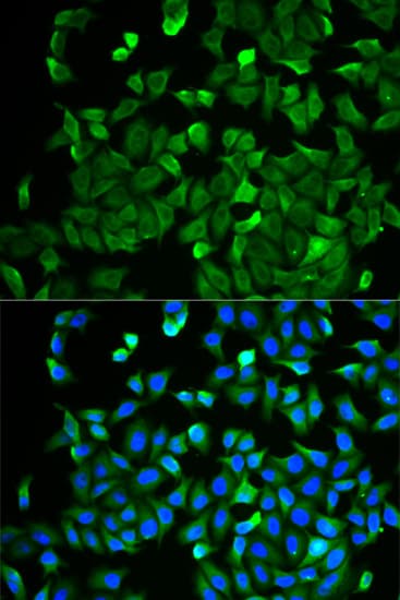 NF2 / Merlin Antibody