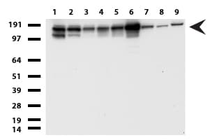 TOP2A / Topoisomerase II Alpha Antibody (aa1100-1531, clone UMAB146)