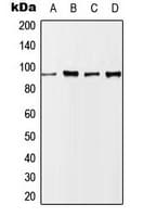 Polyclonal Rabbit anti-Human NBN / Nibrin Antibody (phospho-Ser343, WB)