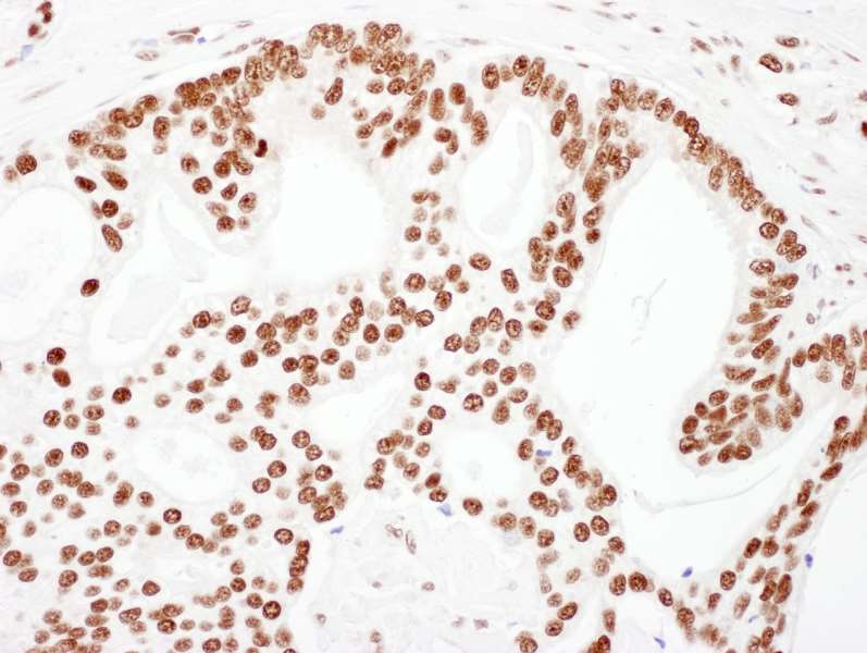 Polyclonal Goat anti-Human TRIM28 / KAP1 Antibody (aa1-50, IHC, WB)