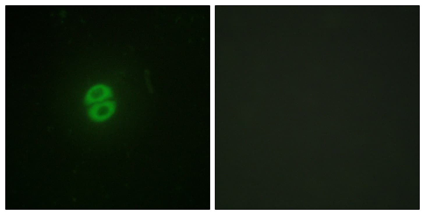 IHC-plus™ TNFSF10 / TRAIL Antibody (aa31-80)