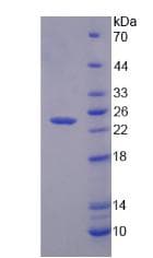 Mouse GZMK / Granzyme K Protein (Recombinant His)