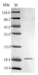 Human FCER1G Protein (Recombinant 6His-B2M, N-terminus)