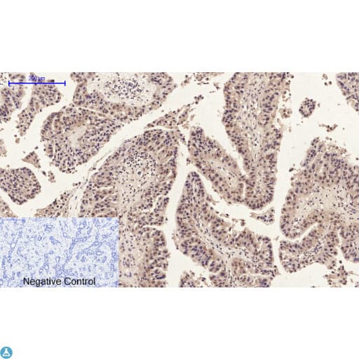 Polyclonal Rabbit anti-Human ANXA1 / Annexin A1 Antibody (IHC, WB)