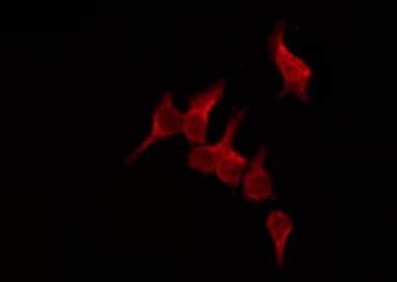 OR51D1 Antibody