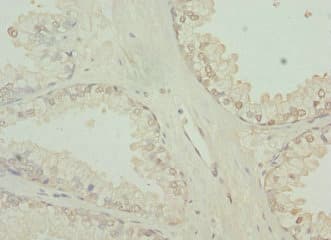 Polyclonal Rabbit anti-Human TCBE / KCS / HRD Antibody (IHC, WB)