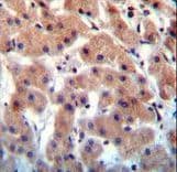 INHBB / Inhibin Beta B Antibody (aa369-397)